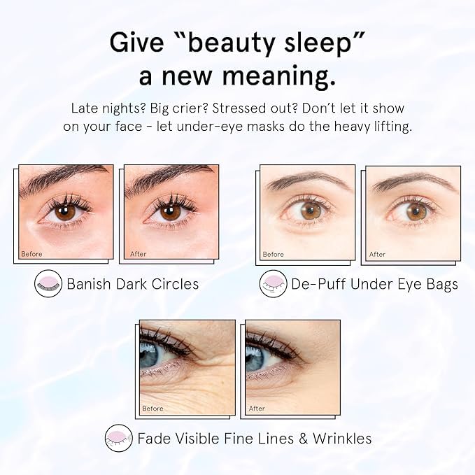 grace & stella Under Eye Masks for Dark Circles (Purple, 24 Pairs) - Gel Eye Mask with Retinol - Restoring Under Eye Patches for Puffy Eyes and Dark Circles - Vegan Cruelty-Free