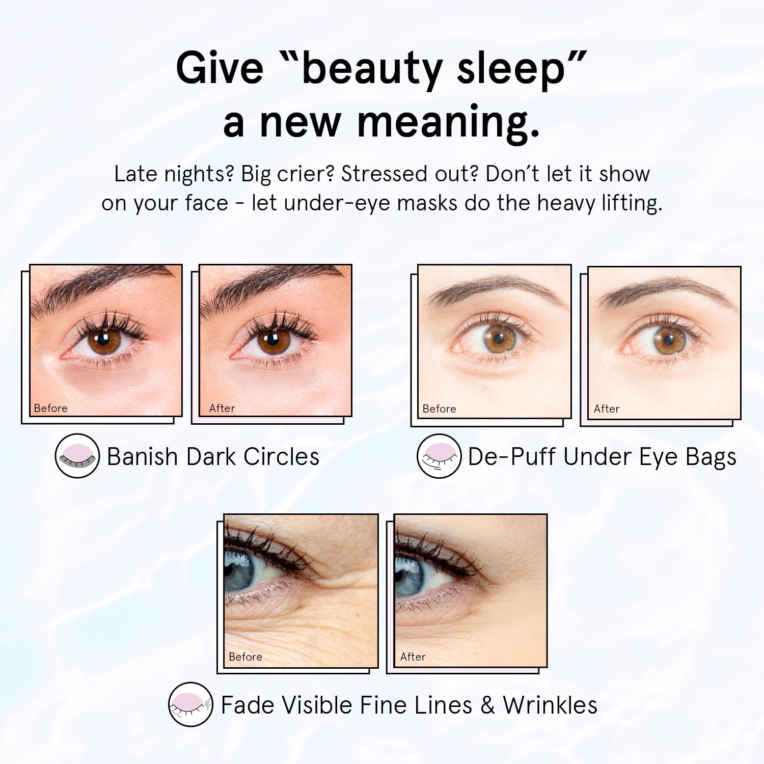 grace & stella Under Eye Masks for Dark Circles (Purple, 24 Pairs) - Gel Eye Mask with Retinol - Restoring Under Eye Patches for Puffy Eyes and Dark Circles - Vegan Cruelty-Free