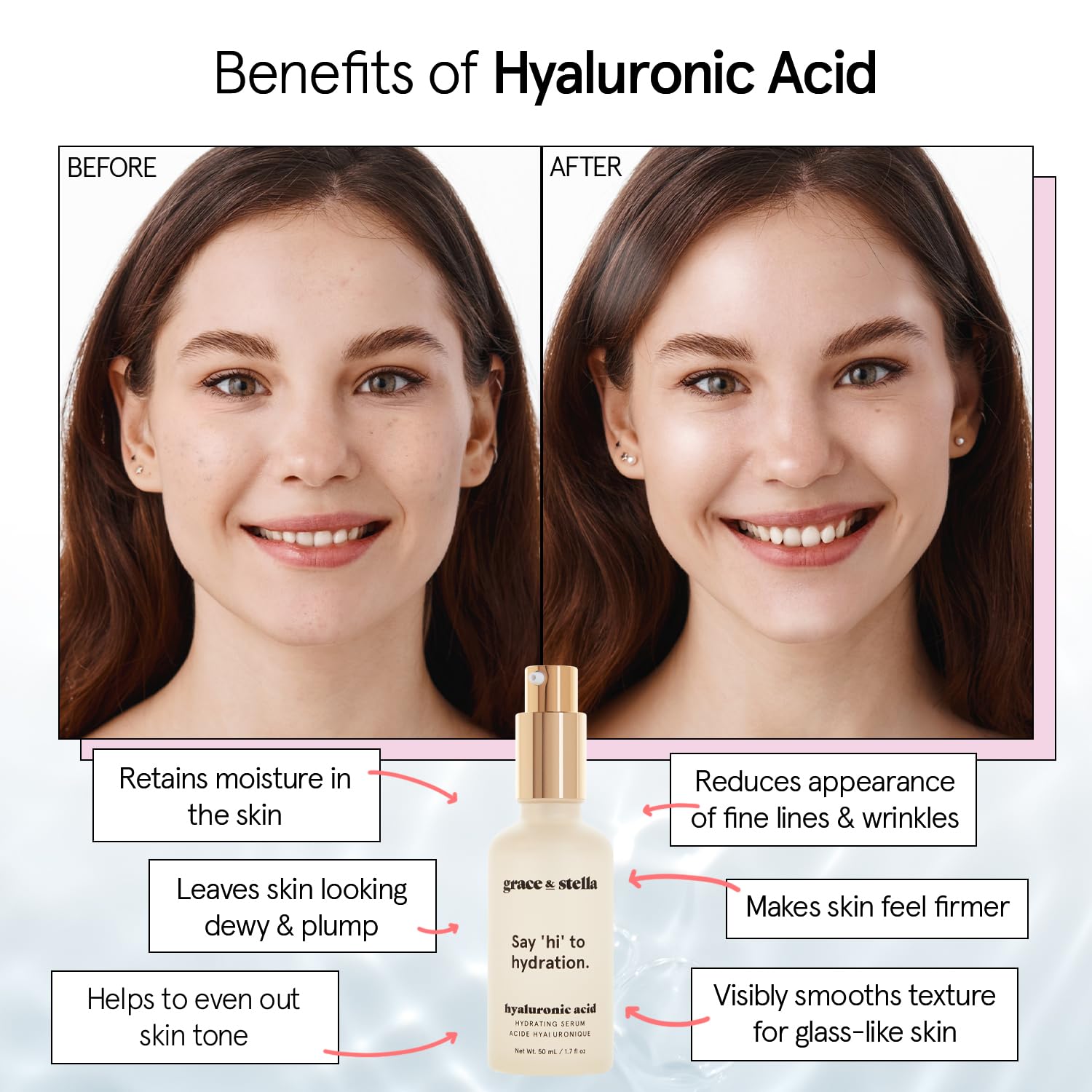 grace & stella Award Winning Hyaluronic Acid Serum (50ml/1.7 fl oz) Hyaluronic Acid Serum for Face