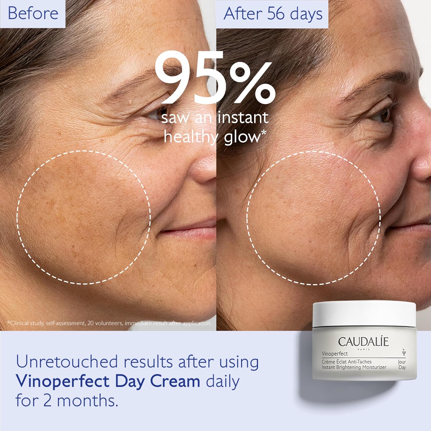 Caudalie Vinoperfect Dark Spot Moisturizer with Niacinamide - 1.7 Fl. Oz