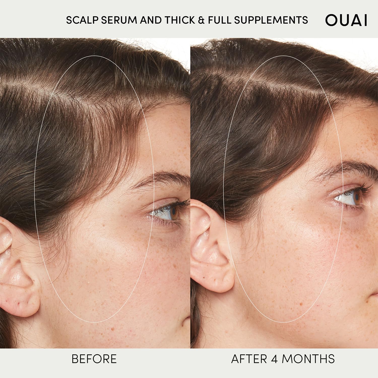 OUAI Scalp Serum - Balancing and Hydrating Serum with Red Clover Extract, Siberian Ginseng and Peptides for Thicker and Fuller-Looking Hair - Paraben, Phthalate and Sulfate Free Scalp Care (2 Fl Oz)