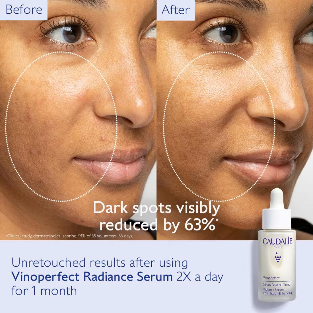 Caudalie Vinoperfect Radiance Serum Complexion Enhancing