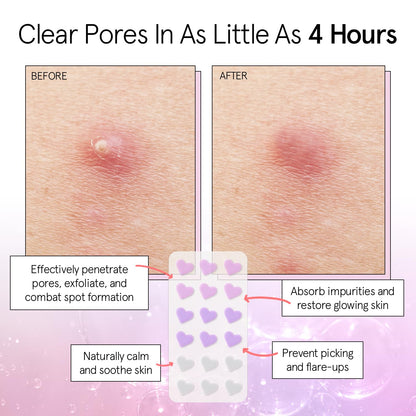 grace &amp; stella Pimple Patches For Face (Heart, 36 Count) - Hydrocolloid Acne Patches for Face - Dermatologist Tested, Vegan, Cruelty-Free