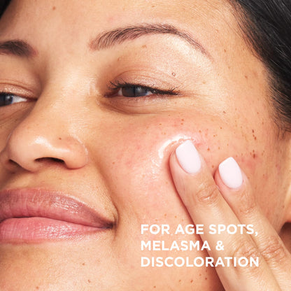 IT Cosmetics Bye Bye Dark Spots 4% Niacinamide Serum - Visibly Reduces Dark Spots &amp; Improves Skin Clarity In 8 Weeks - Facial Serum with 1% Ethyl Vitamin C - For All Skin Types - 1 Fl. Oz