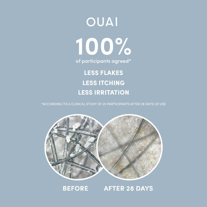 OUAI Detox Shampoo - Clarifying Shampoo for Build Up, Dirt, Oil, Product and Hard Water - Apple Cider Vinegar &amp; Keratin for Clean, Refreshed Hair - Sulfate-Free Hair Care (10 oz)