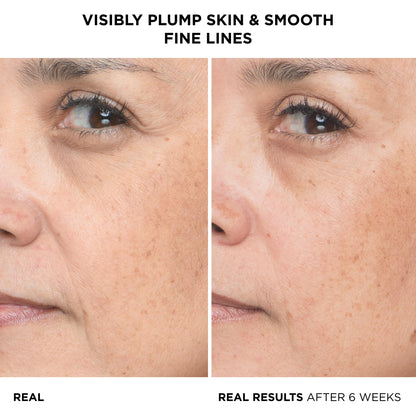 IT Cosmetics Hyaluronic Acid Serum Visibly Plumps Skin &amp; Smooths Lines In 2 Weeks - With Peptide + Vitamin B5 - Vegan Formula - 1 fl oz