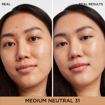 IT Cosmetics Bye Bye Dark Spots Concealer + Brightening Serum – 2% Niacinamide, Hyaluronic Acid &amp; Caffeine - Medium Coverage, Natural Finish, All Skin Types - 0.22 fl oz