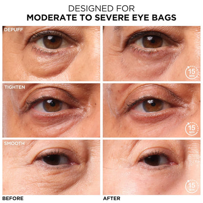 IT Cosmetics Bye Bye Under Eye Bags Treatment For Women &amp; Men – Temporary Eye Bag Reducer &amp; Under Eye Corrector Depuffs, Tightens, Smooths &amp; Reduces Look of Wrinkles &amp; Fine Lines - 0.5 Fl. Oz