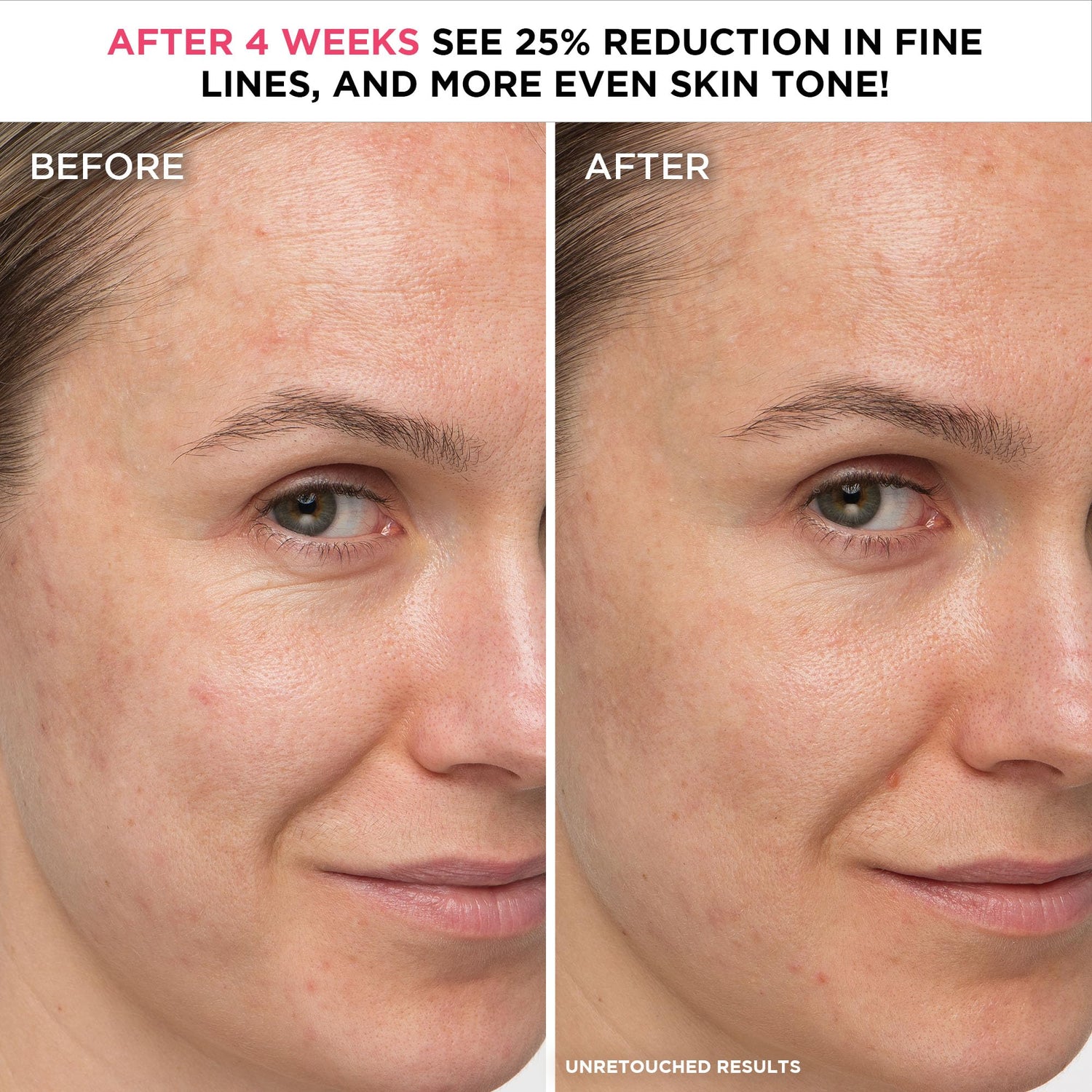 IT Cosmetics Confidence in a Cream Anti Aging Face Moisturizer – Visibly Reduces Fine Lines, Wrinkles &amp; Signs of Aging Skin in 2 Weeks, 48HR Hydration with Hyaluronic Acid, Niacinamide