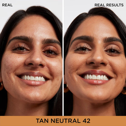IT Cosmetics Bye Bye Dark Spots Concealer + Brightening Serum – 2% Niacinamide, Hyaluronic Acid &amp; Caffeine - Medium Coverage, Natural Finish, All Skin Types - 0.22 fl oz
