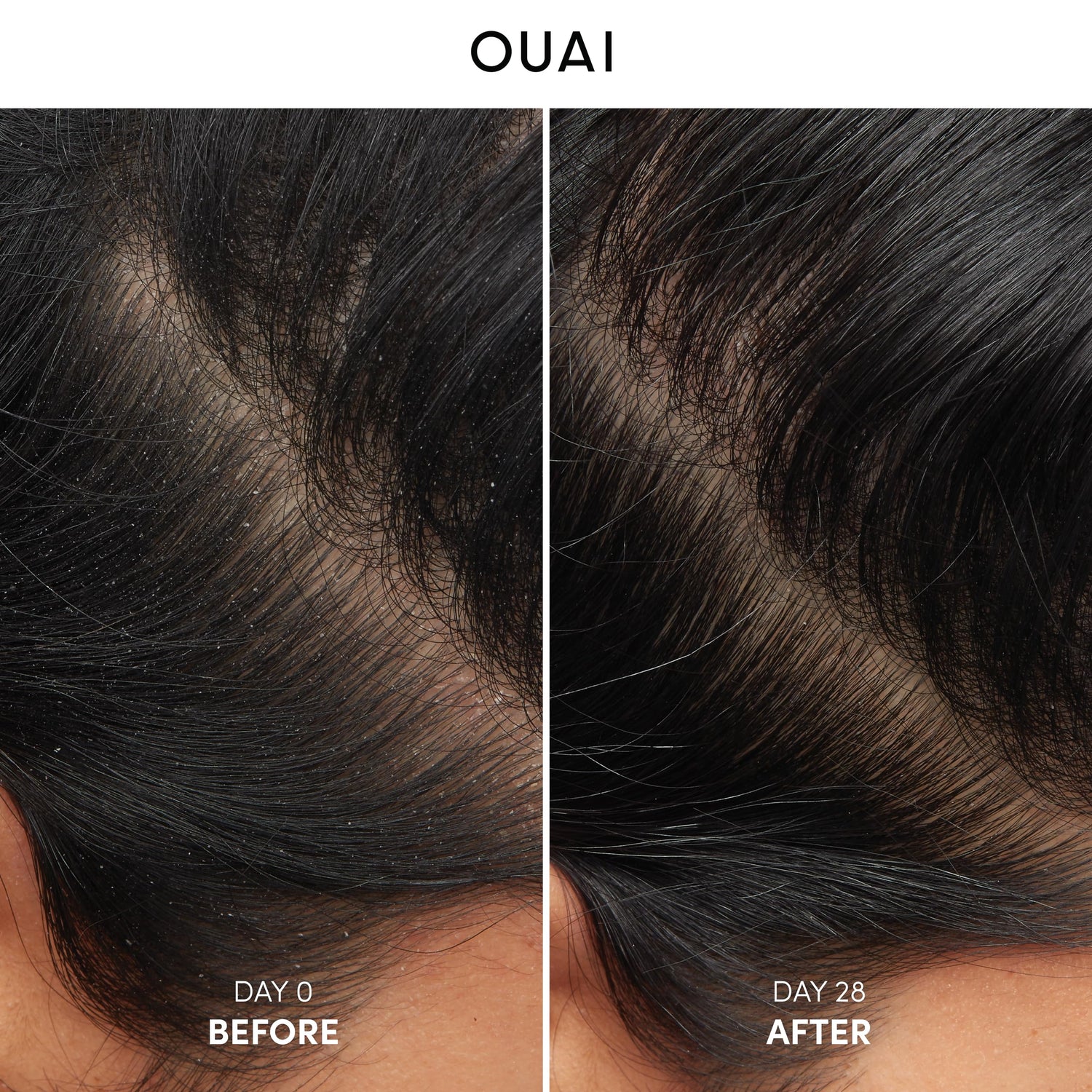 OUAI Detox Shampoo - Clarifying Shampoo for Build Up, Dirt, Oil, Product and Hard Water - Apple Cider Vinegar &amp; Keratin for Clean, Refreshed Hair - Sulfate-Free Hair Care (10 oz)